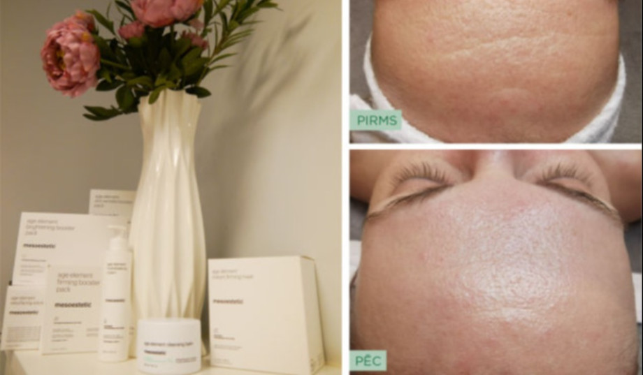 ''Age element'' procedūra – pretnovecošanās efekta sasniegšanai